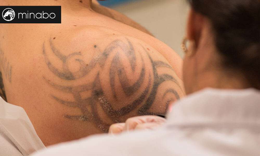 ¿De verdad funciona la crema para quitar tatuajes?